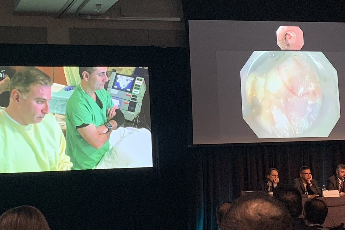 Excellent live demonstration of G-POEM by @alhaddad_mo at Orlando Live Endoscopy #OLE 
@IUGastro