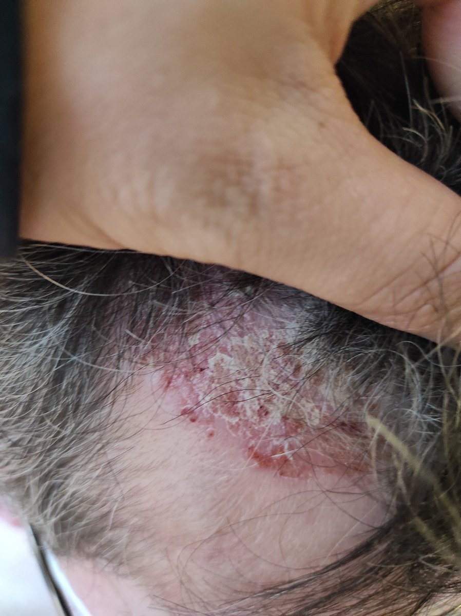 Le 4ème mousquetaire tweet media