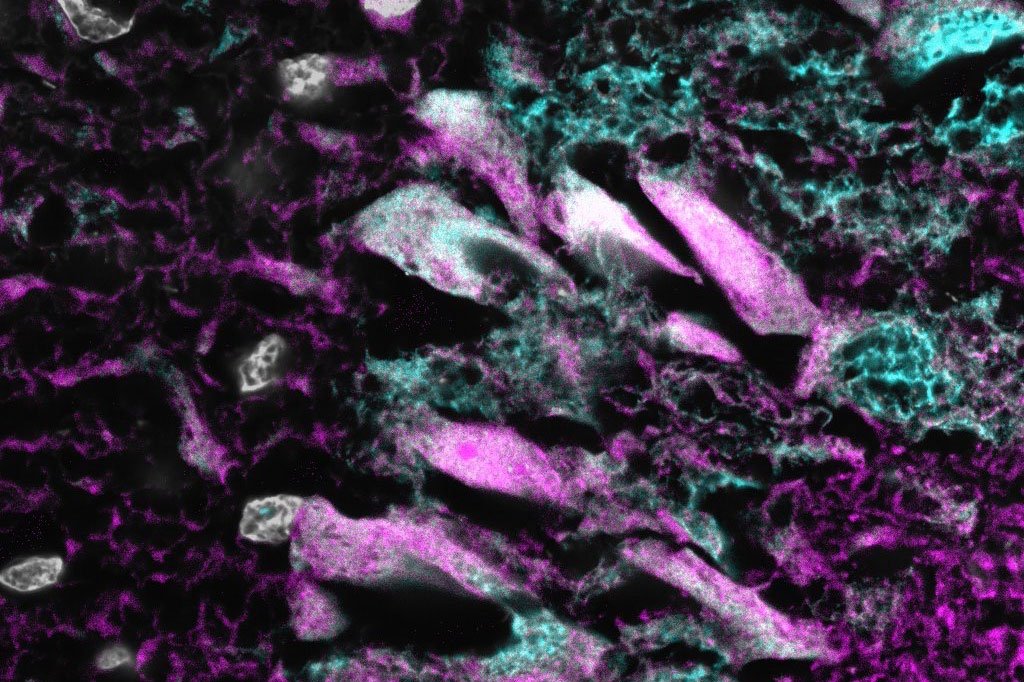 WashU Med Taylor Family Department of Neurosurgery tweet media