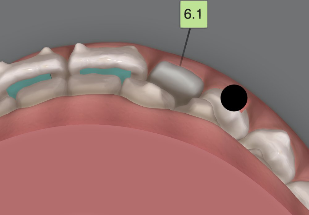 StraightSmile Solutions- We help GPs with ortho! tweet media