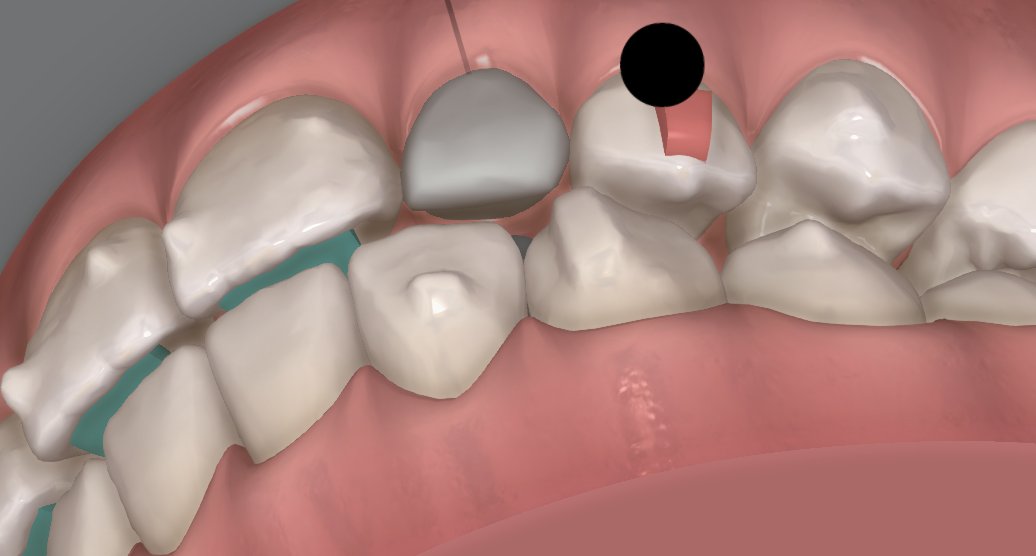 StraightSmile Solutions- We help GPs with ortho! tweet media