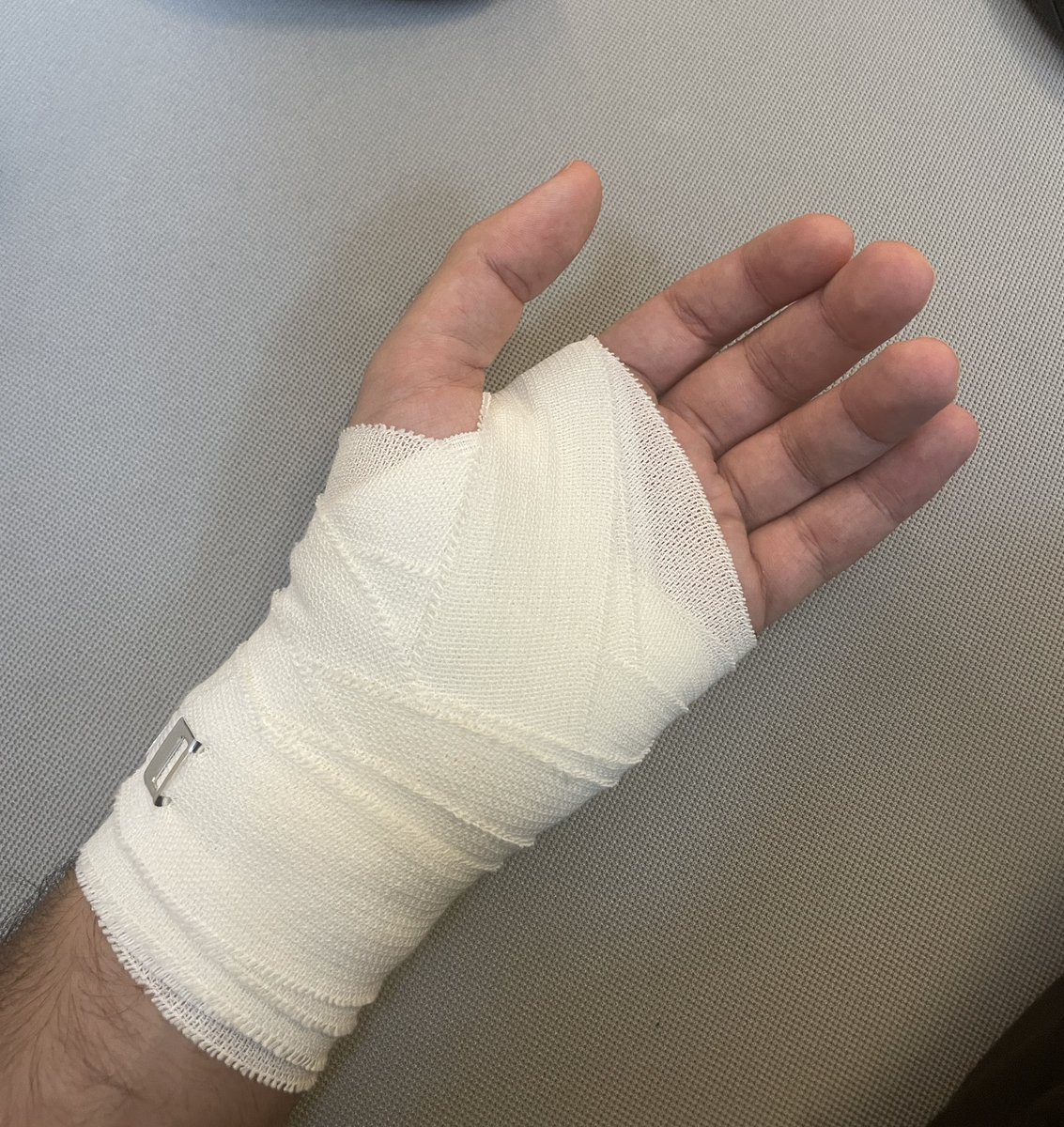 Umut Gültekin on Twitter "Heute eRoller gefahren und hingefallen. Hand verstaucht und