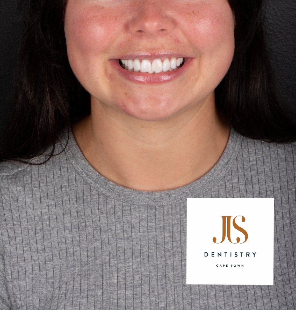 Amazing Smile Makeover!
Do it right!
#jjs #jjsdentistry #capetown #smilemakeover