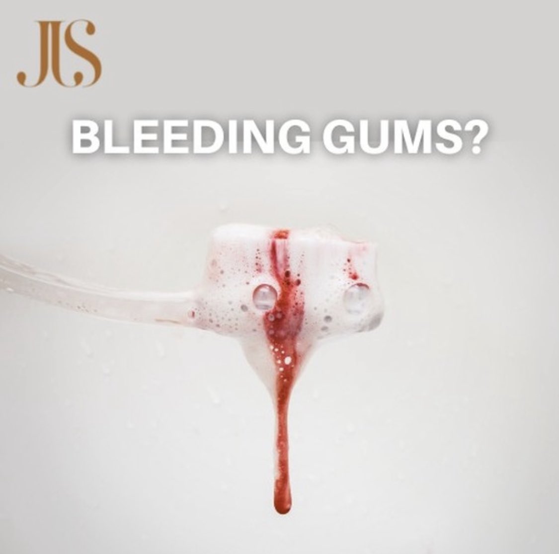 Get off your ass and brush your teeth man!
It’s infected! It’s not healthy! Period!

#bleedinggums #bleeding #jjsdentistry #CapeTown