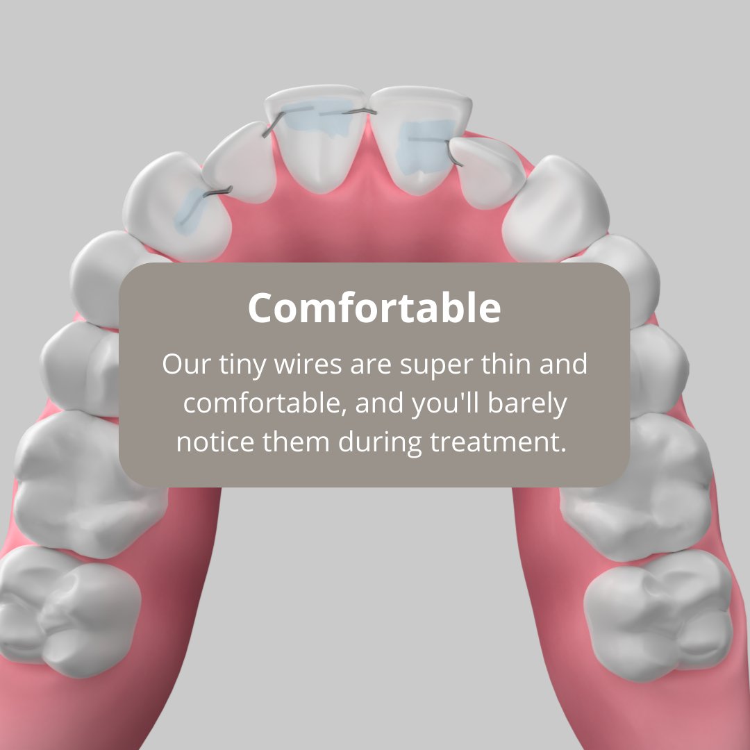 C5HiddenOrtho's tweet image. 🦷 Get to know the 5 C's of C5 Hidden Orthodontics - Custom, Convenient, Concealed, Confidence, and Comfortable. This innovative solution is custom-made to fit your teeth with tiny, behind-the-teeth wires.💥 

#C5hiddenorthodontics #smilewithconfidence #comfortableorthodontics