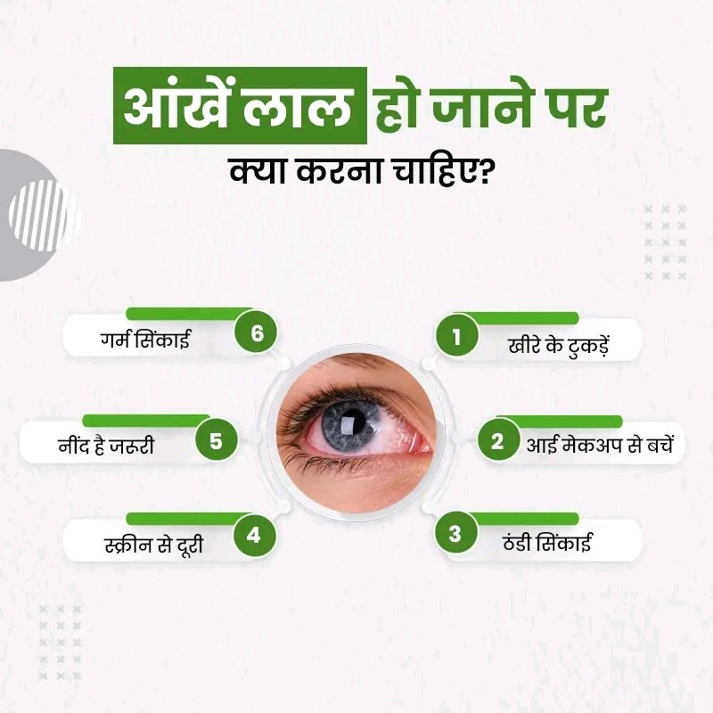 #EyeRedness || आंखें लाल हो जाने पर क्या करना चाहिए?

- गर्म सिंकाई
- खीरे के टुकड़ें
- नींद है जरूरी
- ठंडी सिंकाई
- स्क्रीन से दूरी
- आई मेकअप से बचें

#Eye #HealthyLifestyle #Health