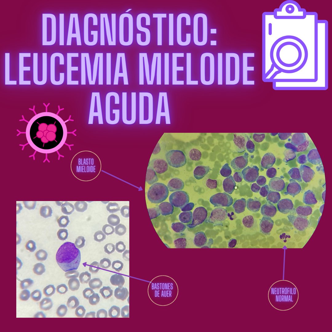CEA_HIBA's tweet photo. Resolvemos el caso del jueves! #MedEd #MedTwitter #DiagnosisChallenge https://t.co/rmVovquIAM