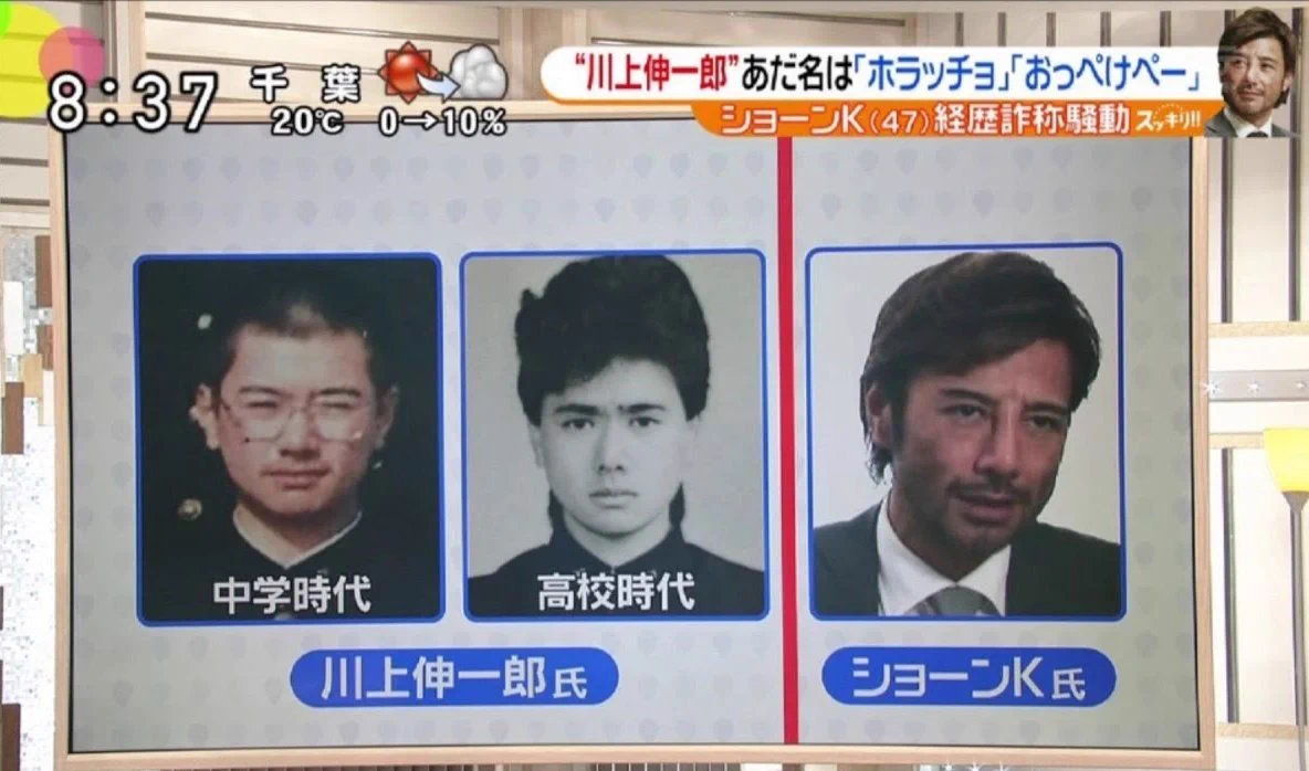 ショーン k 整形 前