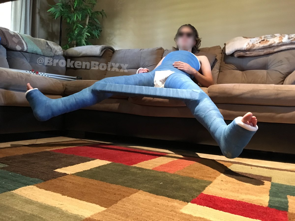 brokenbrosxx's tweet photo. From the archive: Double Hip Spica (DHS) - 2016

#bodycast #hipspica #gips #plaster #yeso #гипс #platre #medicalfetish #castfetish #castedtoes #castedtoes #legcasts #doublehipspica https://t.co/r5FTEx2RAO