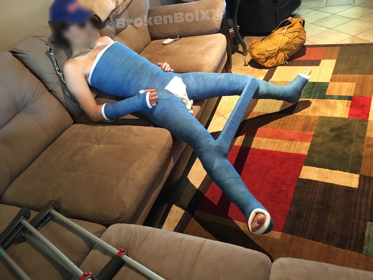 brokenbrosxx's tweet photo. From the archive: Double Hip Spica (DHS) - 2016

#bodycast #hipspica #gips #plaster #yeso #гипс #platre #medicalfetish #castfetish #castedtoes #castedtoes #legcasts #doublehipspica https://t.co/r5FTEx2RAO