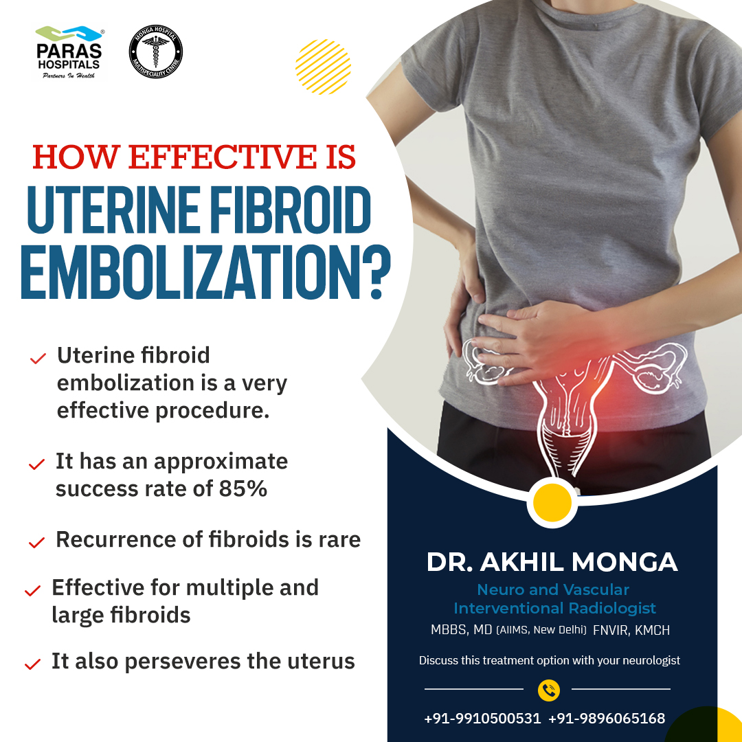 Uterine fibroid embolization (UFE), also called uterine artery embolization, is performed by an interventional radiologist. It is a minimally invasive procedure.
bit.ly/3CD6fmC
#uterinefibroidembolization #uterinefibroids #fibroids #uterinehealth
