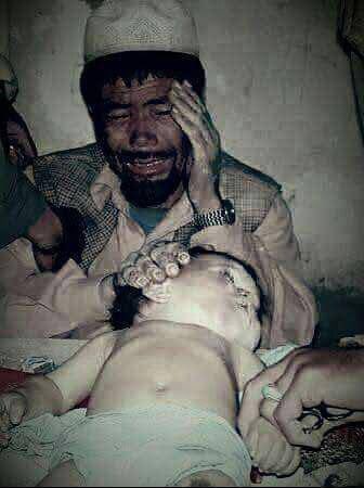 e_amini74's tweet photo. زخم ناسور #افشار
#StopHazaraGenocide https://t.co/gEuzW0xxCS