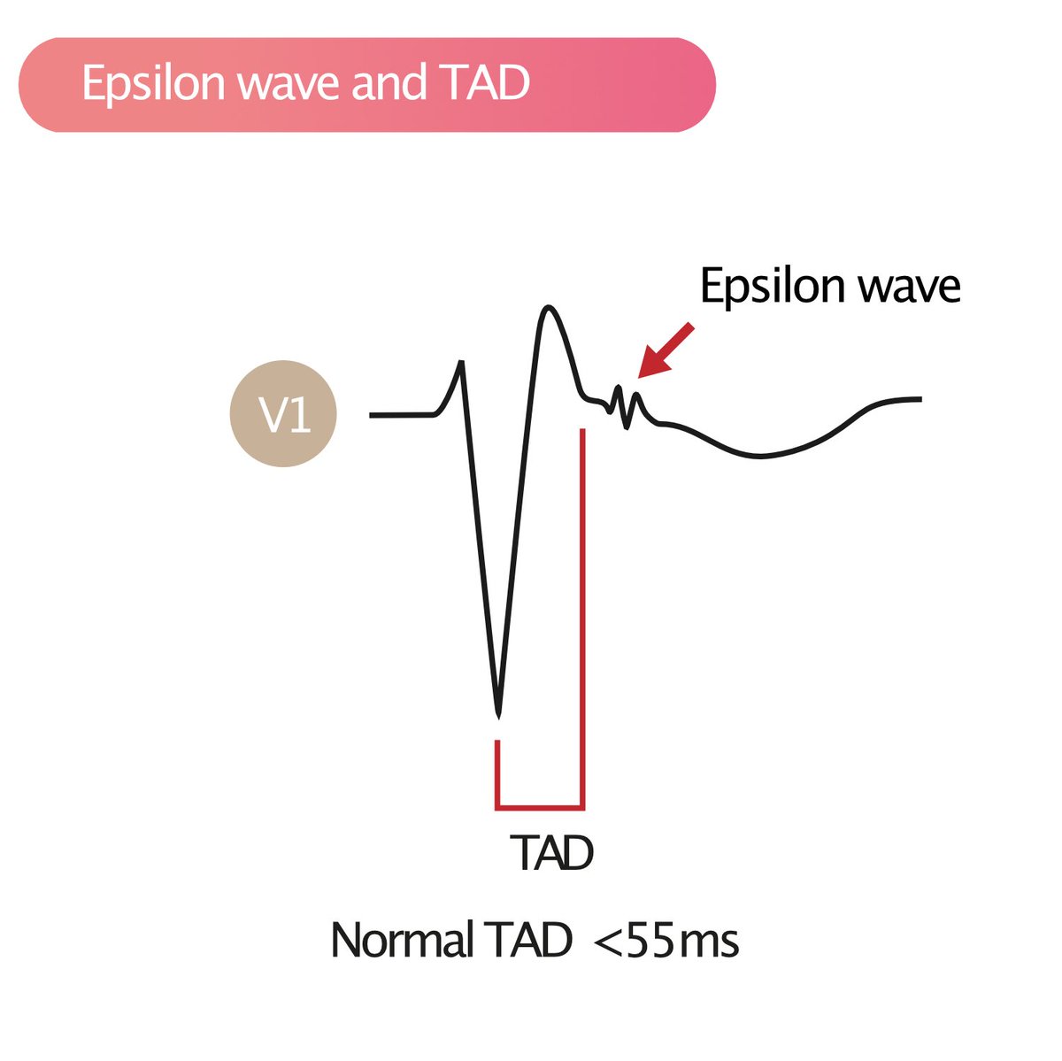 MattersoftheH14's tweet photo. #EpsilonWave https://t.co/S4nNfj9PGd