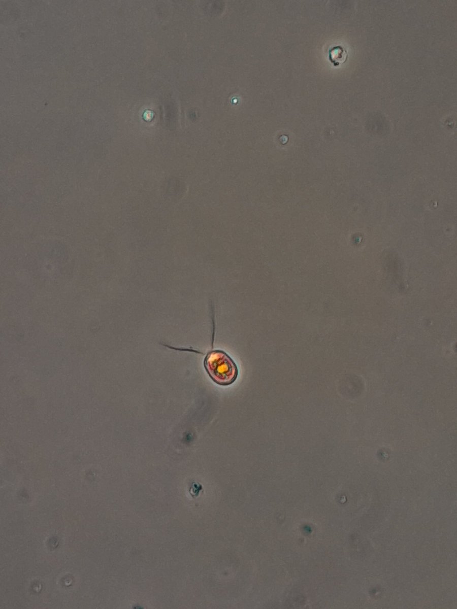 NotAPrimeNumber's tweet photo. Left work early to have a nerve conduction study on my left arm. I'm sore and tingly but it's #PhycologyFriday time.
The summer is in full swing & I'm seeing lots of pretties... & some potentially nasty stuff too.
#greenalgae #desmid #goldenalgae #diatom https://t.co/CrWYfXhXDj