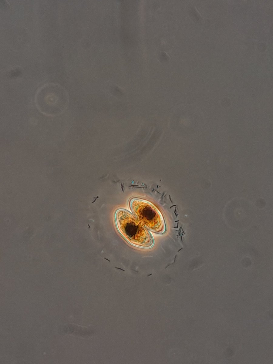 NotAPrimeNumber's tweet photo. Left work early to have a nerve conduction study on my left arm. I'm sore and tingly but it's #PhycologyFriday time.
The summer is in full swing & I'm seeing lots of pretties... & some potentially nasty stuff too.
#greenalgae #desmid #goldenalgae #diatom https://t.co/CrWYfXhXDj