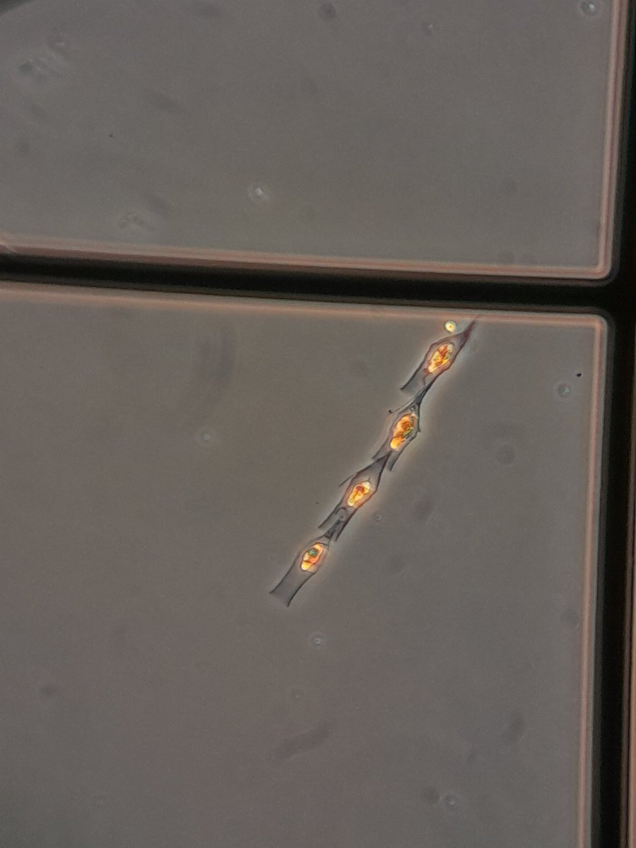 NotAPrimeNumber's tweet photo. Left work early to have a nerve conduction study on my left arm. I'm sore and tingly but it's #PhycologyFriday time.
The summer is in full swing & I'm seeing lots of pretties... & some potentially nasty stuff too.
#greenalgae #desmid #goldenalgae #diatom https://t.co/CrWYfXhXDj