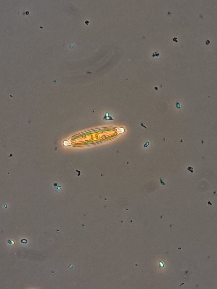 NotAPrimeNumber's tweet photo. Left work early to have a nerve conduction study on my left arm. I'm sore and tingly but it's #PhycologyFriday time.
The summer is in full swing & I'm seeing lots of pretties... & some potentially nasty stuff too.
#greenalgae #desmid #goldenalgae #diatom https://t.co/CrWYfXhXDj