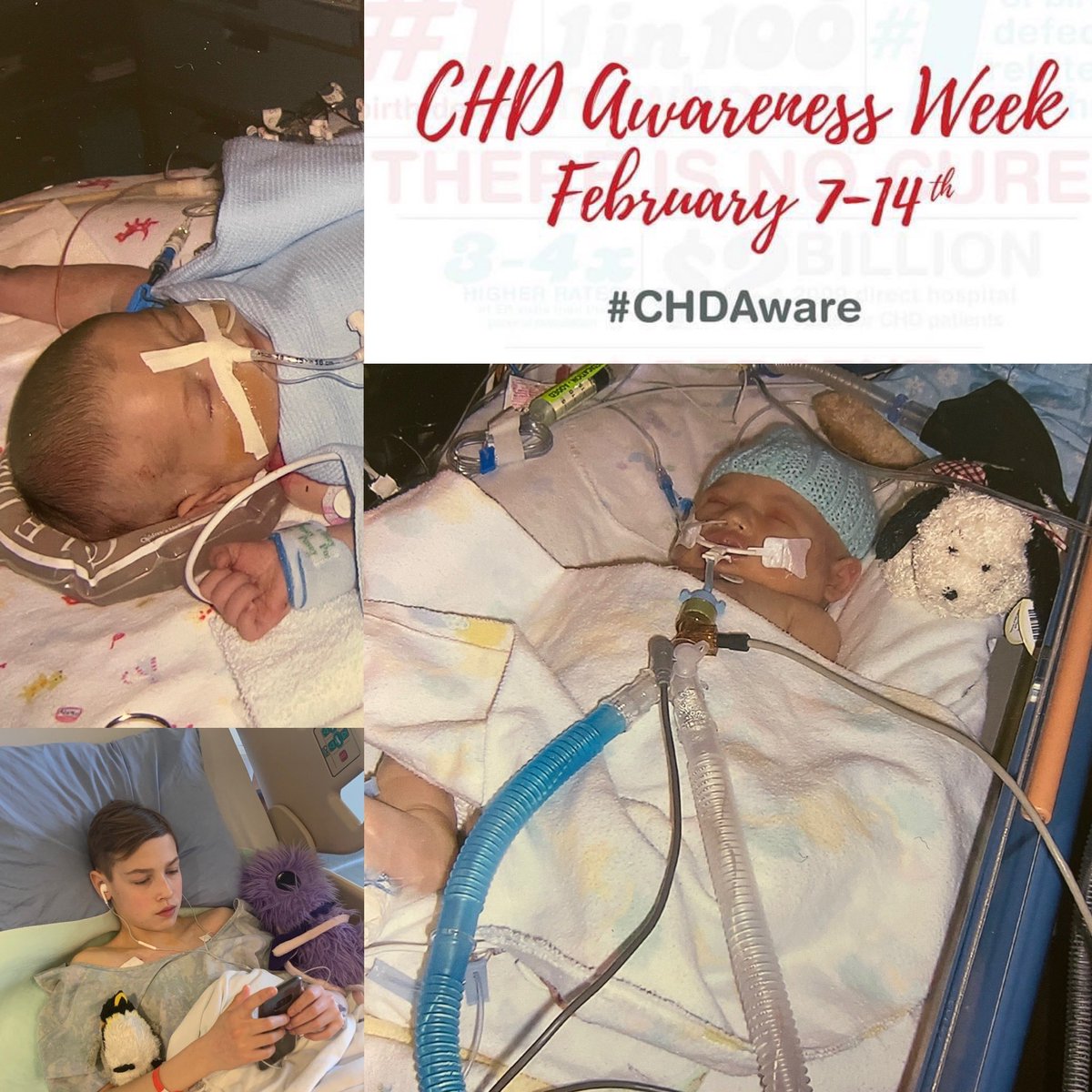 Many CHD kids have multiple surgeries, Kailen has had 3 heart related surgeries, along with more procedures and tests that I can account for. #CHDAwarenessWeek #chdwarrior #chdheartmom <a href="/Childrens_Heart/">childrens_heart</a>