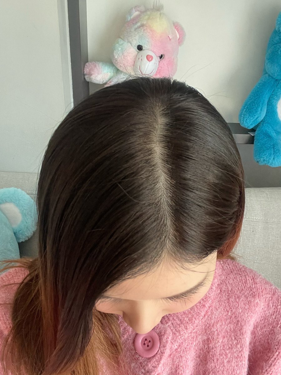 pearseprem's tweet photo. เราควรเจอกันเร็วกว่านี้ นี่ทนกับผมร่วงมาตั้งนาน🥹 เป็นเยลลี่บำรุงผมที่อร่อยไม่ไหว555 กินมาพักนึงแล้ว ผมร่วงน้อยลงจริงอะ ตอนนี้คือผมใหม่ขึ้นจนไปสระร้านแล้วช่างทักว่าลูกผมเยอะดีจัง จะกินไปเรื่อยๆละ ไม่มีน้ำตาลไม่อ้วนด้วยเริ่ด 🫶🏻#Qloe #QloeGetter #BeautyPleasureByQloe #รีวิวQloe https://t.co/o80mMjusPf