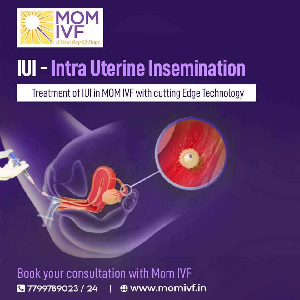 MomIvf's tweet image. Intra-Uterine Insemination (IUI) can bring you the joy of parenthood.

To Book An Appointment, Contact Us @ 7799789023 /24
.
#IVF #Fertilitytreatment #momivf #Fertilitycentre #poornimadurga #parenthood #iui #iuitreatment #drpoornimadurga #infertility