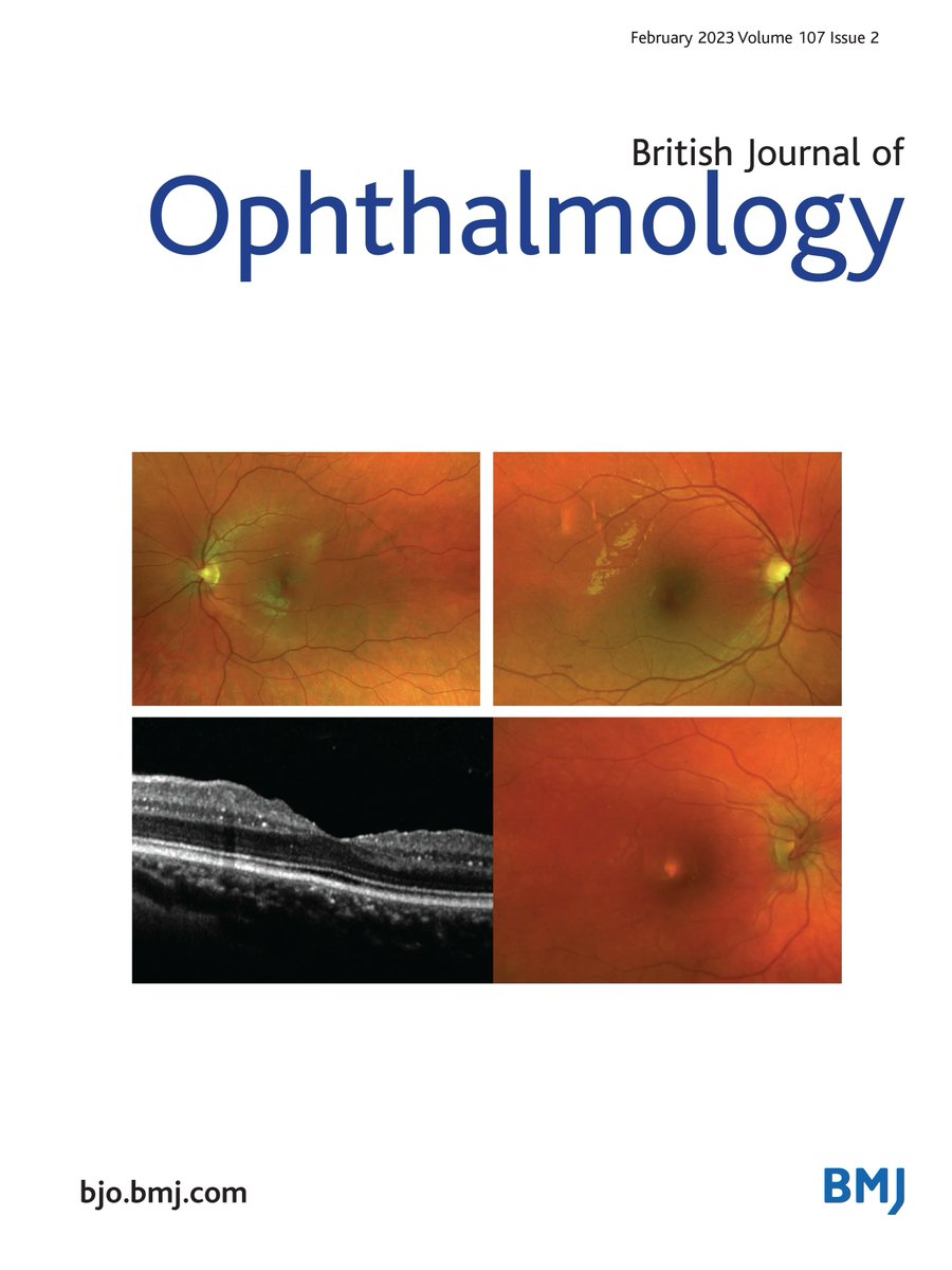 andresvilarino's tweet photo. Validation of a #DeepLearningSystem for the detection of #diabeticRetinopathy in Indigenous Australians

#DeepLearning #DL #DLSs #ArtificialIntelligence #AI #ML #MachineLearning #Algorithm #Data #NeuralNetworks #HealthCare #HealthTech #MedicalTech #MedTech
https://t.co/rBeUFjqaip https://t.co/AR4e0BKB8W
