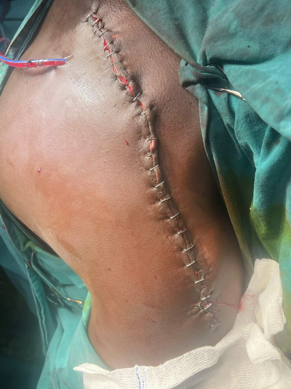 SomalisVoices's tweet photo. Disturbing images coming from Laascaanood hospitals of the injured from the the shelling by Muse Bihi militia

@amnesty 
@AmnestyUK 
@amnestyusa 
@NewsFromAmnesty 
@Amnesty_Norge https://t.co/pg2rLme0G7