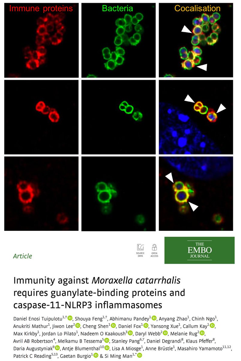 Si Ming Man (@simingman1) on Twitter photo ⭐ Check out our new paper published in The <a href="/embojournal/">The EMBO Journal</a> on mammalian immune proteins helping us to fight the respiratory pathogen Moraxella catarrhalis.🔬🦠
embopress.org/doi/full/10.15… ⭐ Check out our new paper published in The <a href="/embojournal/">The EMBO Journal</a> on mammalian immune proteins helping us to fight the respiratory pathogen Moraxella catarrhalis.🔬🦠
embopress.org/doi/full/10.15…