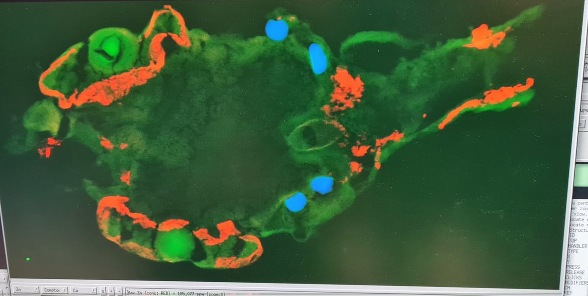 Playing at Australian synchrotron  on XFM looking at redistribution of metals due to Cu exposure <a href="/EcotoxGroup/">Biogeochem_Ecotox_Group</a>