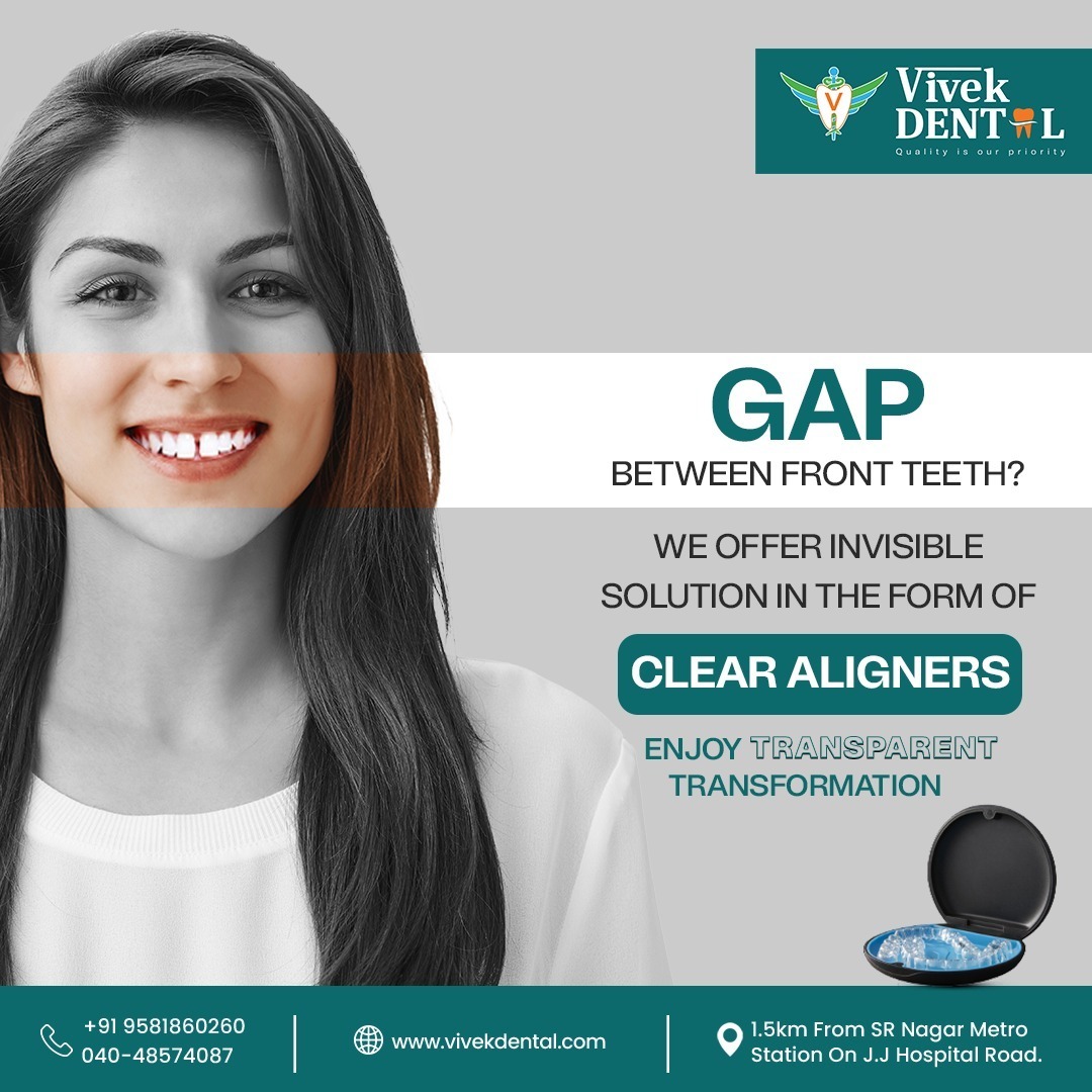 vivekdotdental's tweet image. Are you worried about the gaps between your front teeth?
Stop worrying and consult Vivek Dental at the earliest.
We offer the best solutions to increase the beauty of your smile through clear aligners.
#vivekdental #hyderabad #teethgap #aligners #dental #dentist #dentalcare
