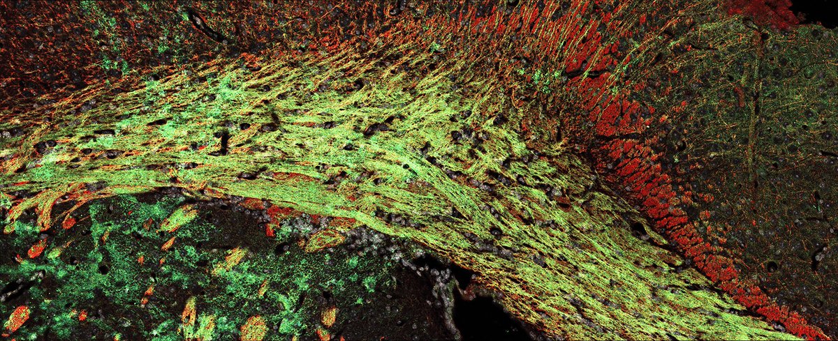 Colin Crawford (@colinphd) on Twitter photo This week <a href="/_GA_Craig/">Dr. Georgina Craig</a> introduced me to SCoRe imaging, a label-free way of assessing myelin damage. Here you can see the SCoRe signal in green-cyan, with intense signals showing compact vs. non-compact myelin. Myelin basic protein is in red, and nuclei in white. #FluorescenceFriday This week <a href="/_GA_Craig/">Dr. Georgina Craig</a> introduced me to SCoRe imaging, a label-free way of assessing myelin damage. Here you can see the SCoRe signal in green-cyan, with intense signals showing compact vs. non-compact myelin. Myelin basic protein is in red, and nuclei in white. #FluorescenceFriday
