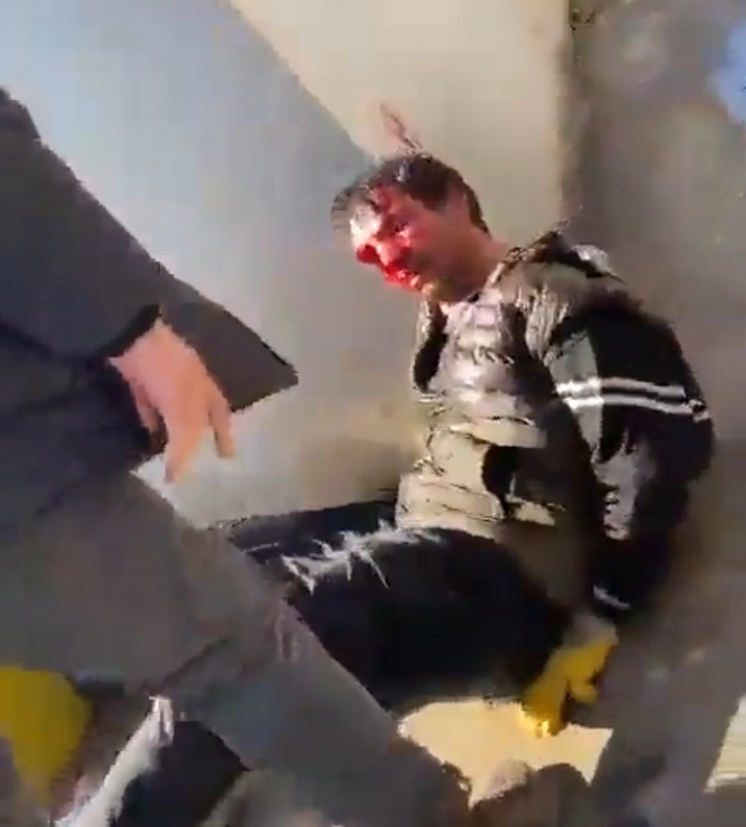 HASSAS İÇERİK!
Hatay'a yardım götüren yardımları durdurup, tırcı ağabeye hakaretler yağdıran; "SEVE SEVE" ineceksin diye köpekleşen, sözde HDP adına yardım toplayan, ÇAKALA ASLANLARIMIZ ŞEFKATİNİ GÖSTERMİŞ.

ELİNİZ DERT GÖRMESİN. ALLIĞI BİRAZ FAZLA KAÇMIŞ FİSTANLININ...