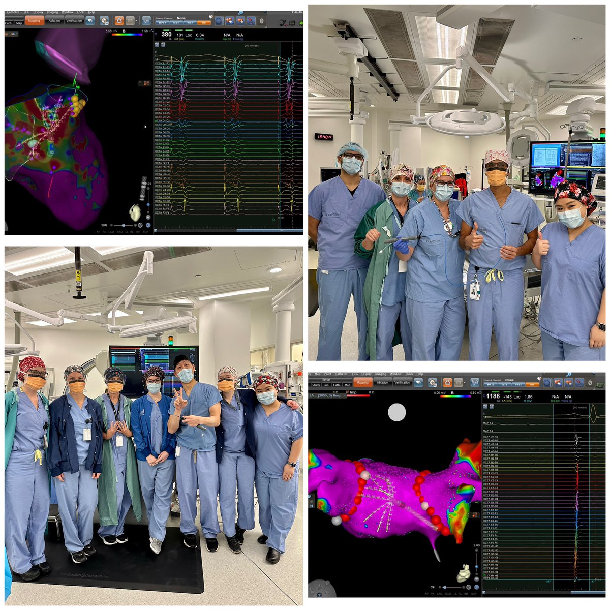 It has been an amazing week mapping with #Octaray ! <a href="/williamkchan/">William Chan</a> 
#firstoctaraycaseincanada #EPeeps #biosensewebster