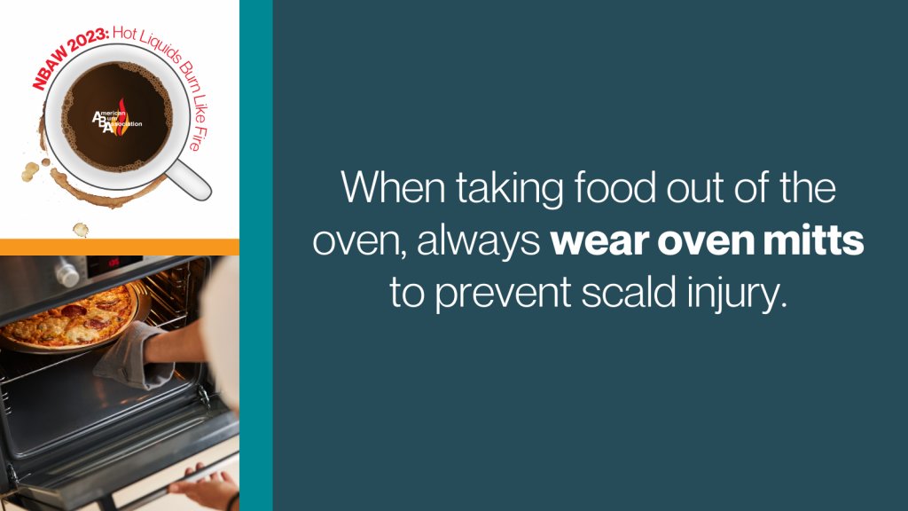 UCIBurnCenter's tweet photo. All right so we've already got our 3 foot kid free zone in the kitchen. Now lets practice safety taking things out of the oven. Bust out those oven mitts to keep those hands safe! #Burnprevention #NBAW https://t.co/g4xjtwAVFb