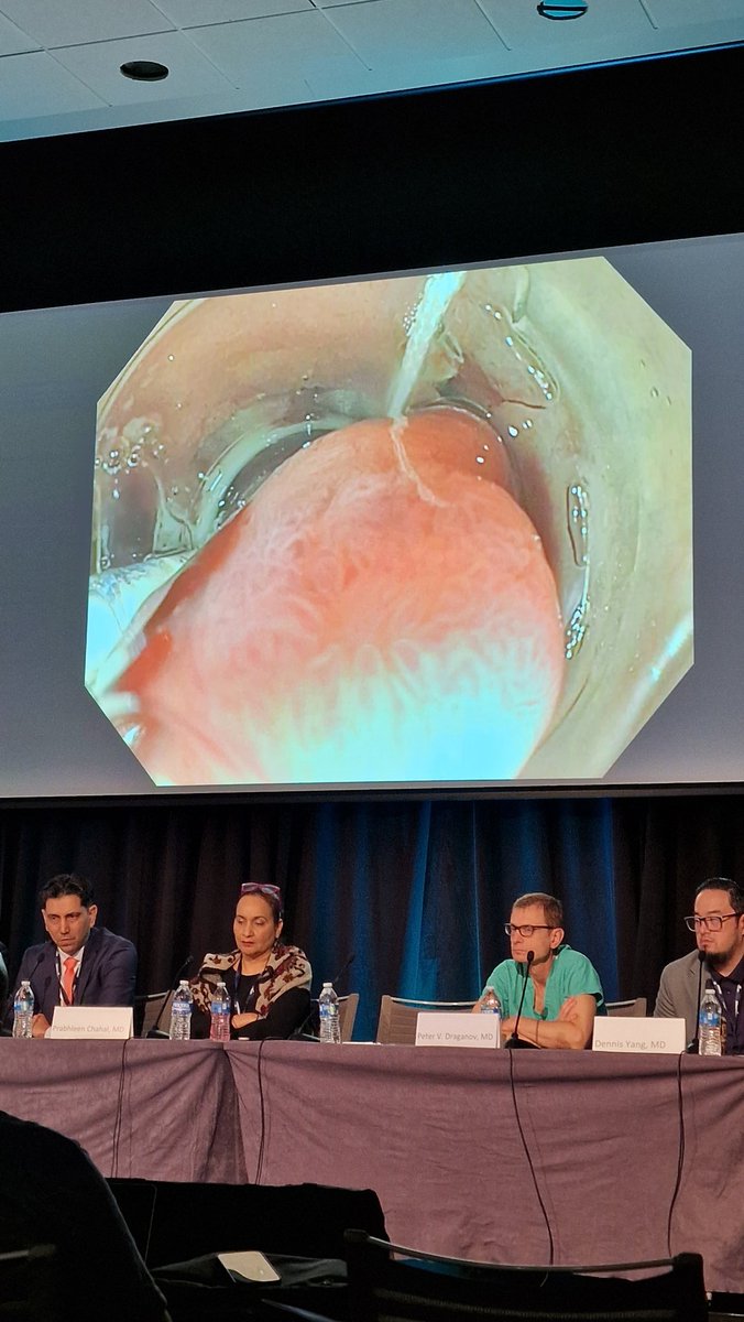 SyedGerdezi's tweet photo. Mastero @KKadkhodayan in action, with skilful full-thickness resection of #GIST from D1 with #OVESCO pre-treatment.
#OLE2023 https://t.co/ZFgwk2rjRk