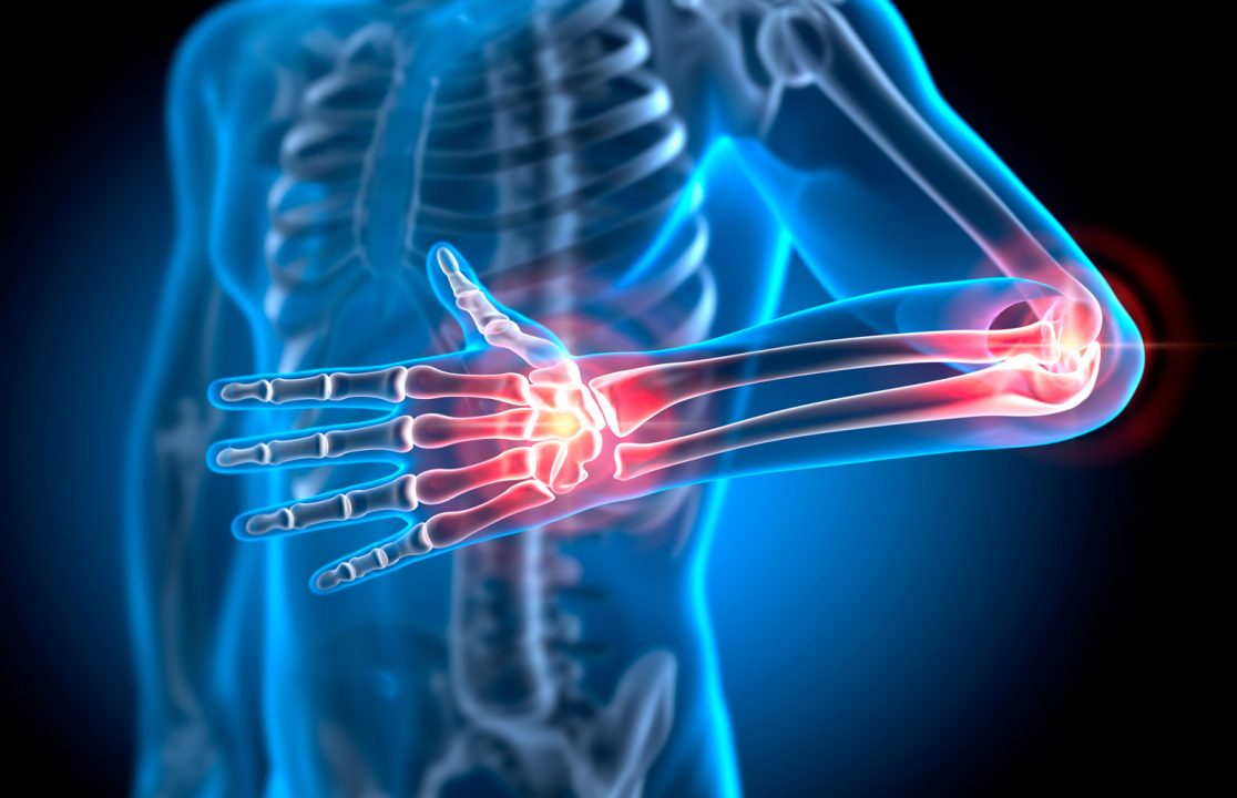 on Twitter "New breakthrough in the treatment of rheumatoid arthritis