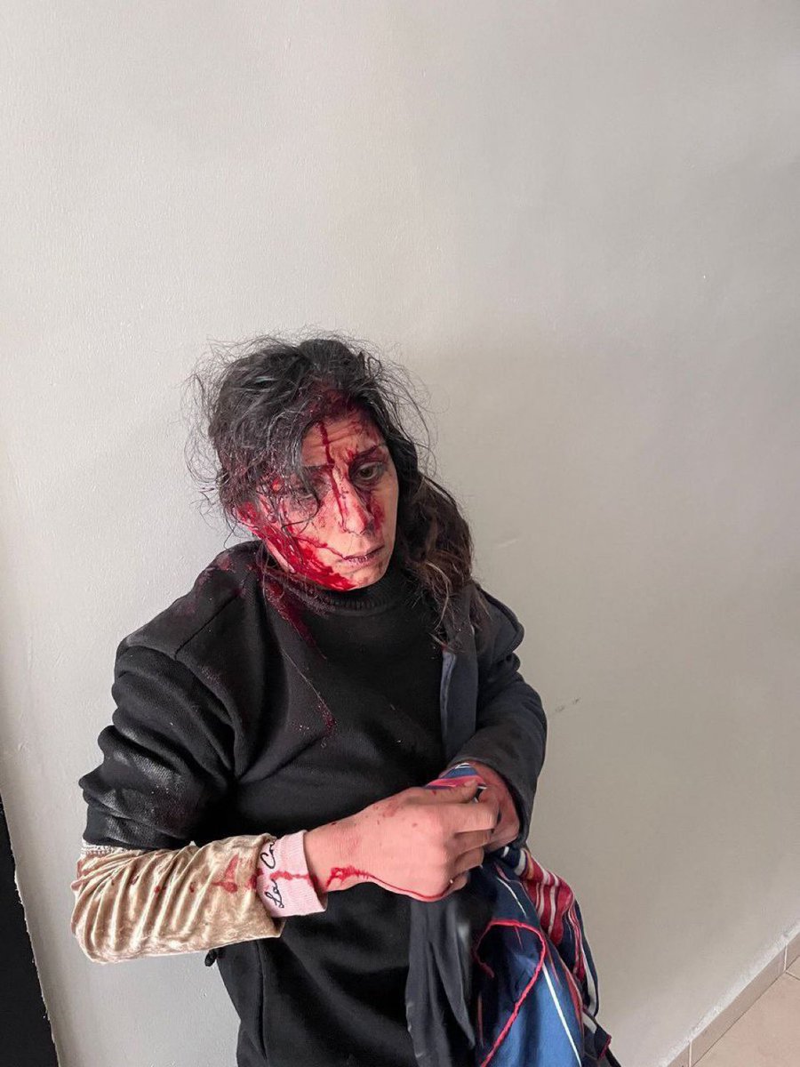 Küçük bir depremzede kız çocuğuna şiddet gösterip gülüp eğlenebileceğini mi sandın?Sana az bile...