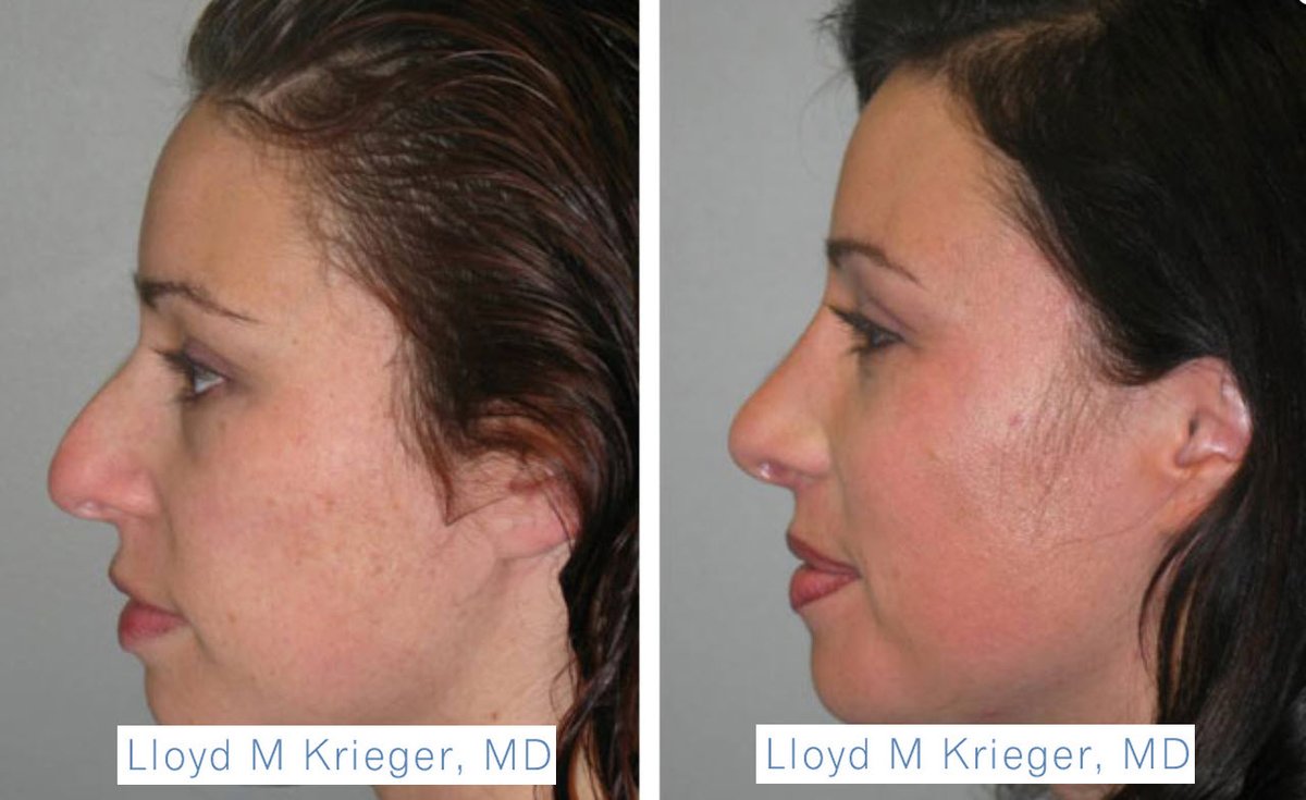The Portland Center for Facial Plastic Surgery tweet media