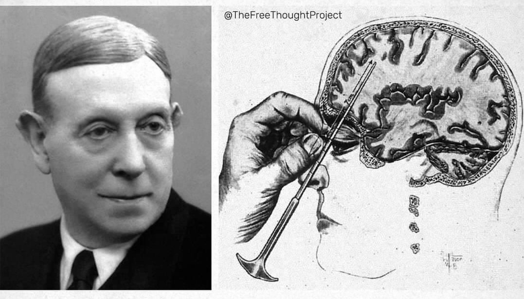 DrEliDavid's tweet image. In 1949 Dr. Antonio Moniz received the Nobel Prize for medicine, for invention of lobotomy.

“The science was settled.”

Hundreds of thousands of lives were destroyed with this cruel unscientific procedure, with horrifying results.