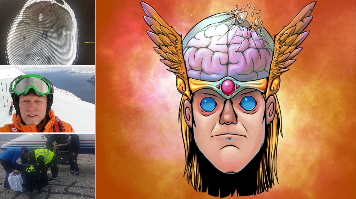 CardanoThor's tweet photo. In 2019, my dad suffered a severe brain injury while skiing. For weeks, he didn't recognize me. 3 years later, his recovery has been miraculous.

This #Helmy is a tribute to all those affected by brain injuries and a reminder of how fragile our most important organ is. https://t.co/4FVEfPdhcZ