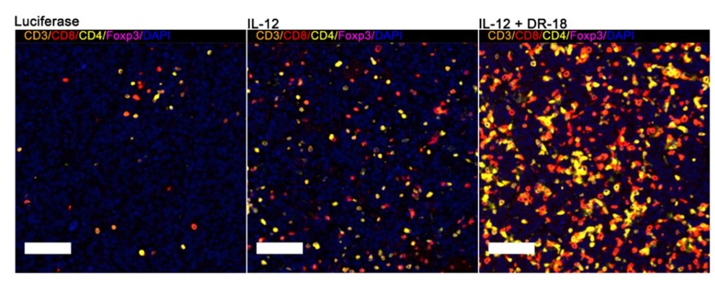CIR_AACR's tweet photo. New in the February issue - Intratumoral Gene Transfer of #mRNAs Encoding IL12 in Combination with Decoy-Resistant IL18 Improves Local and Systemic Antitumor Immunity. Study by A. Cirella, E. Bolanos, P. Berraondo, I. Melero et al.
https://t.co/4HVZleievC
@claditti @CIMA_unav https://t.co/rTXL5McrZ8