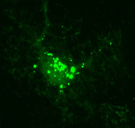 alisonbrack's tweet photo. We're seeing these aggregates of Zsgreen1 when expressed in astrocytes under the gfaABC1D promoter in cortex. Has anyone else seen these aggregates? Any tips on preventing them? https://t.co/b6hlJ0Tm45