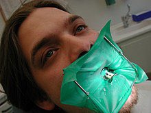 raisov09's tweet photo. Jm trop taper des monologues une fois cet mega digue mise en plzce mskn le patient est pris au piege il a 0 echappatoire possible obligés d’ecouter mes galer de la vi pdt 2h cpour ca les dentistes se sentent jamais seul dans la vie tj des auditeur fidel present contre leur gré https://t.co/bBJkVmPtYG