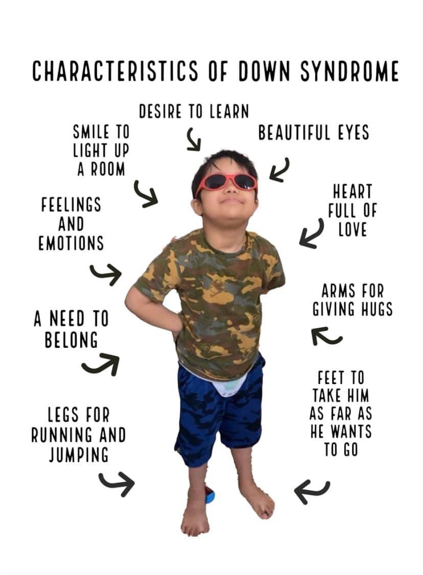 Characteristics of Down’s syndrome aren’t scary! I wish that when people googled “Down’s syndrome” images like this popped up. What a difference it would make if people saw real people &amp; heard real stories #redefinewhatyouseeonline #DownSyndrome <a href="/Wouldntchangea1/">#wouldntchangeathing</a> @ChromosomesNews