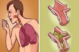 10 علاجات منزلية قد تخلصك من البلغم بعد نزلات البرد..
اذا مشغول فضلها وارجع لها بعدين 🌹