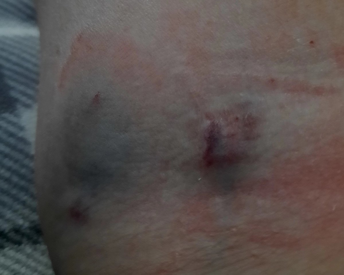 Christine Bore 💙 tweet media