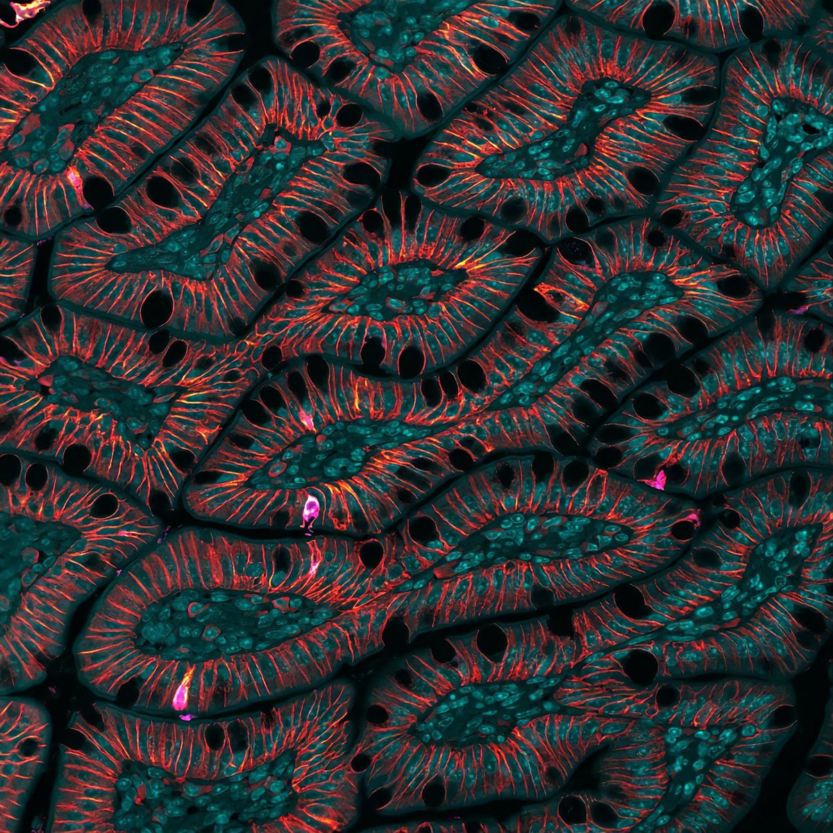 schumacherama's tweet photo. Goblet cells and friends #microscopy https://t.co/6C7oom06qB