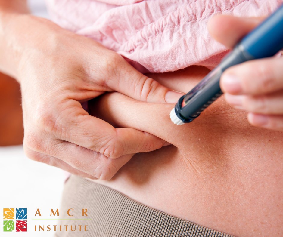 This article includes four personal experiences managing type 1 diabetes while taking a GLP-1 medication (Ozempic, Rybelsus, Trulicity) - Learn more: bit.ly/3xeyTY8
.
#myAMCR #GLP1 #DiabetesMedication #DiabetesManagement #DiabetesHealth