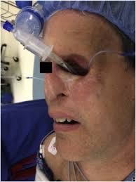 Kudos to anesthesiologists (case from literature)