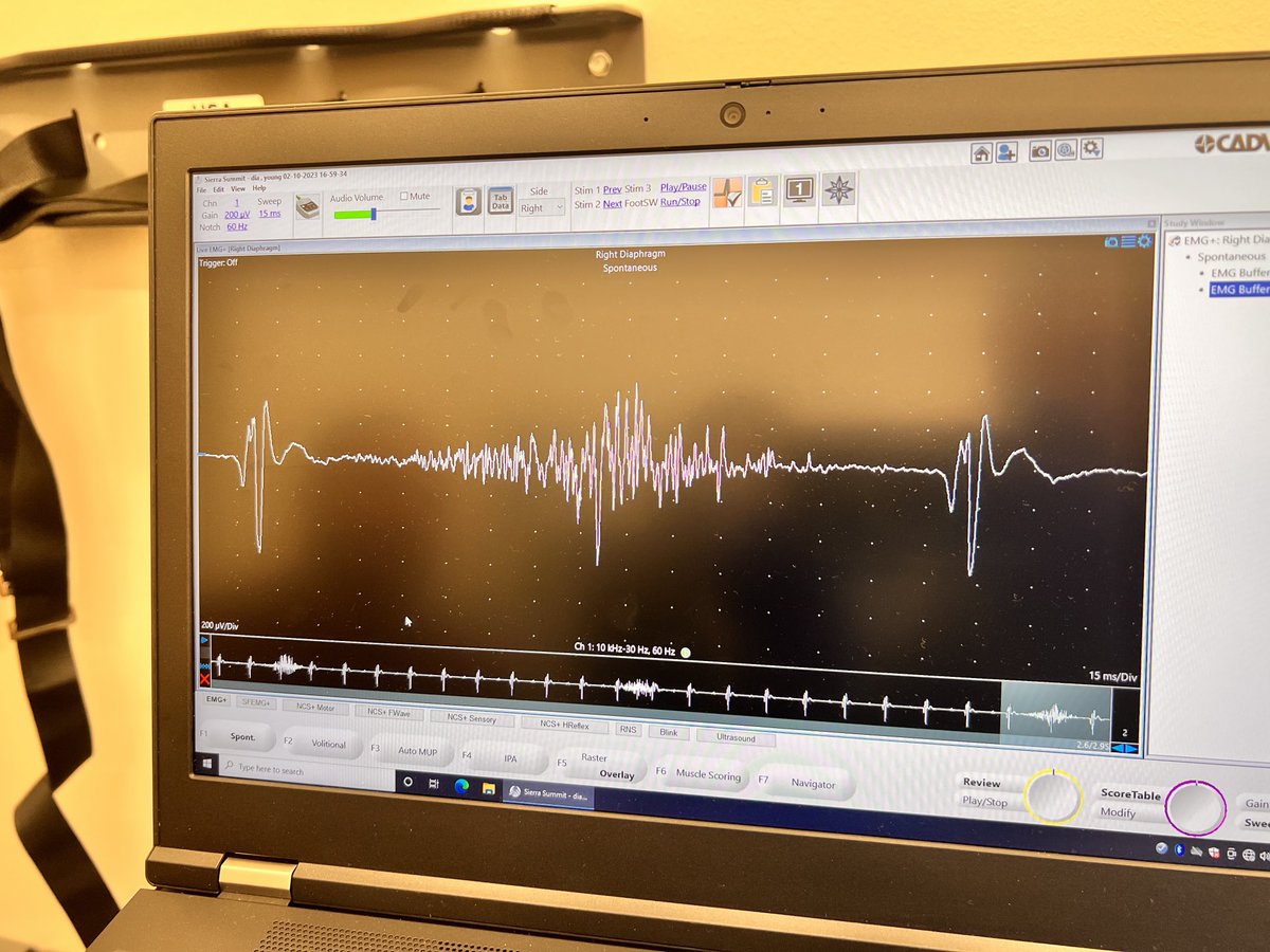 DaveArnoldLab's tweet image. Working on a new collaborative approach for mouse diaphragm EMG! ⁦@LorsonLab⁩ ⁦@sara_ricardez⁩ ⁦@fereshtehbd⁩
