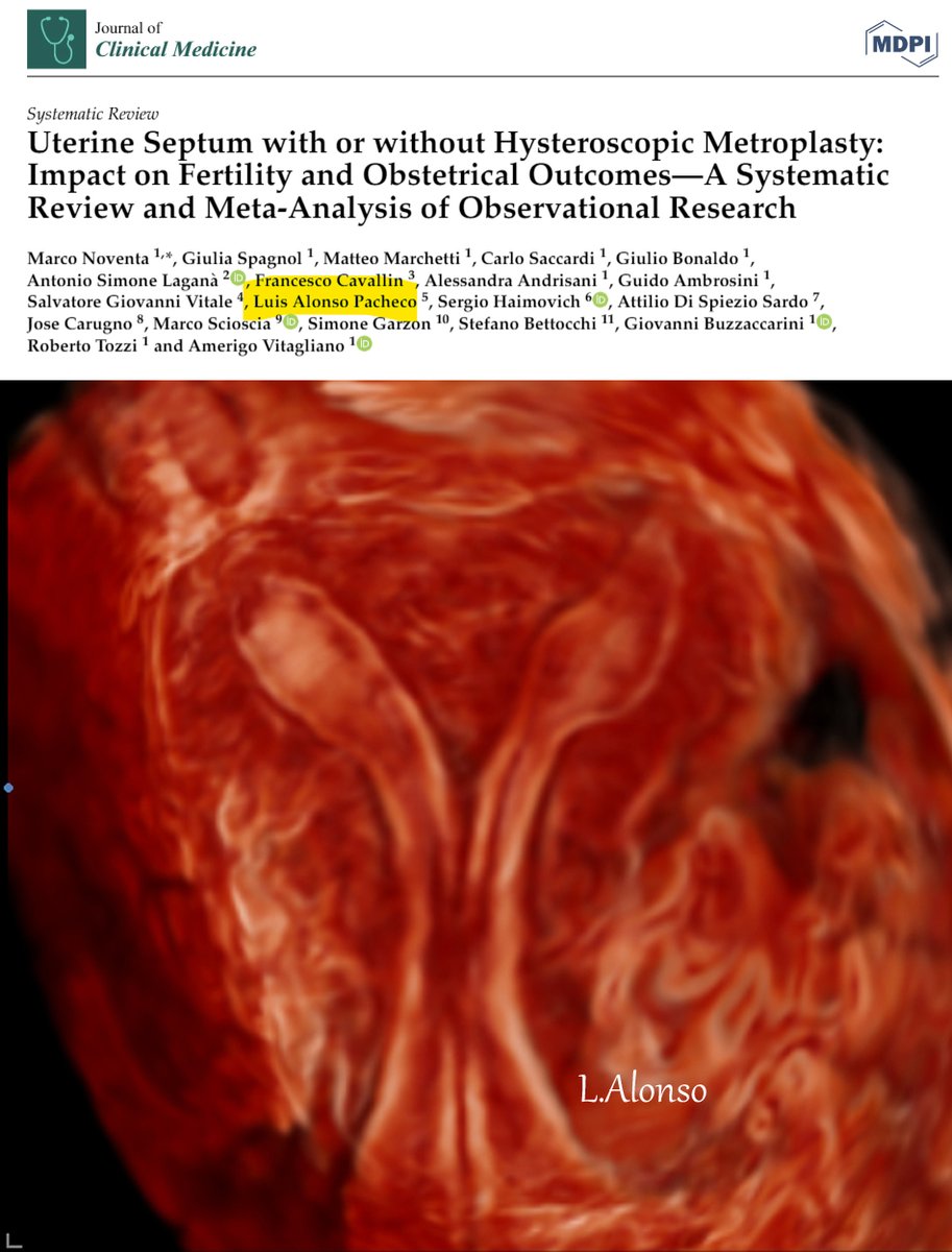 La evidencia disponible sugiere una relación entre el útero septo y los malos resultados reproductivos (Menor tasa de embarazo y nacido vivo, mayor tasa de aborto y parto prematuro) comparado con el útero normal. La cirugía del septo reduce la tasa de aborto espontáneo.